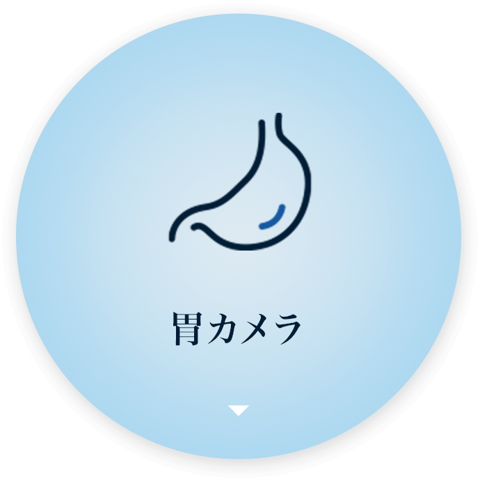 胃カメラ